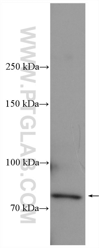 WB analysis of mouse liver using 22233-1-AP