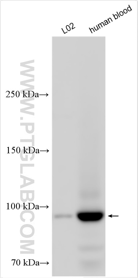 Western Blot (WB) analysis of various lysates using C4 Alpha Chain/C4b/C4d Polyclonal antibody (22233-1-AP)