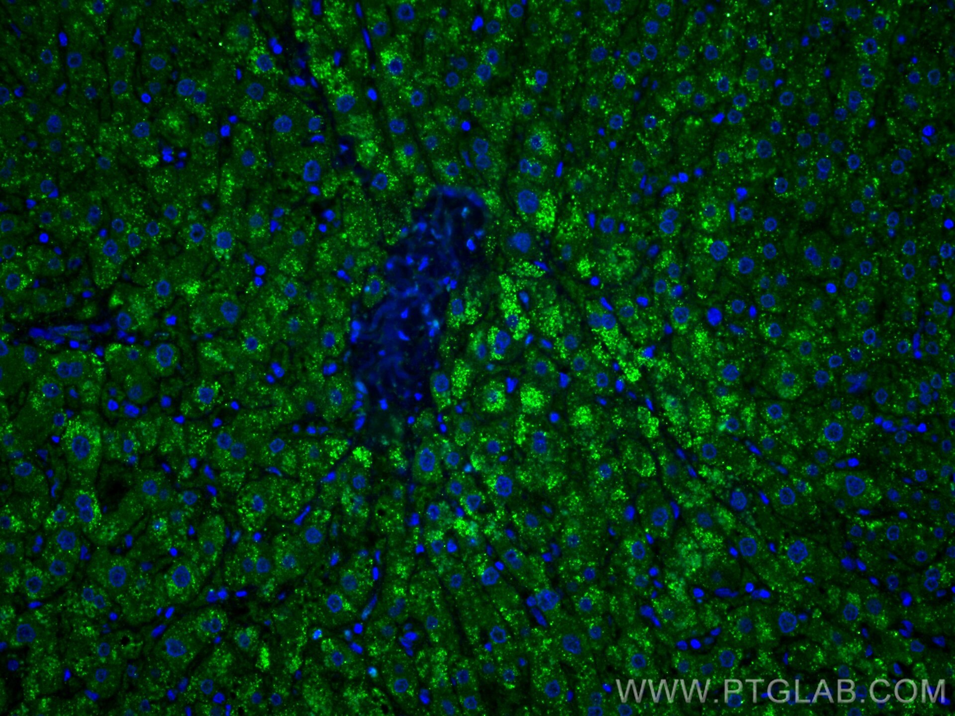 Immunofluorescence (IF) / fluorescent staining of human liver tissue using C4 Gamma Chain Monoclonal antibody (66242-1-Ig)