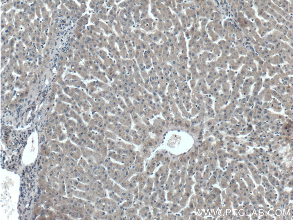 Immunohistochemistry (IHC) staining of human liver tissue using C4 Gamma Chain Monoclonal antibody (66242-1-Ig)