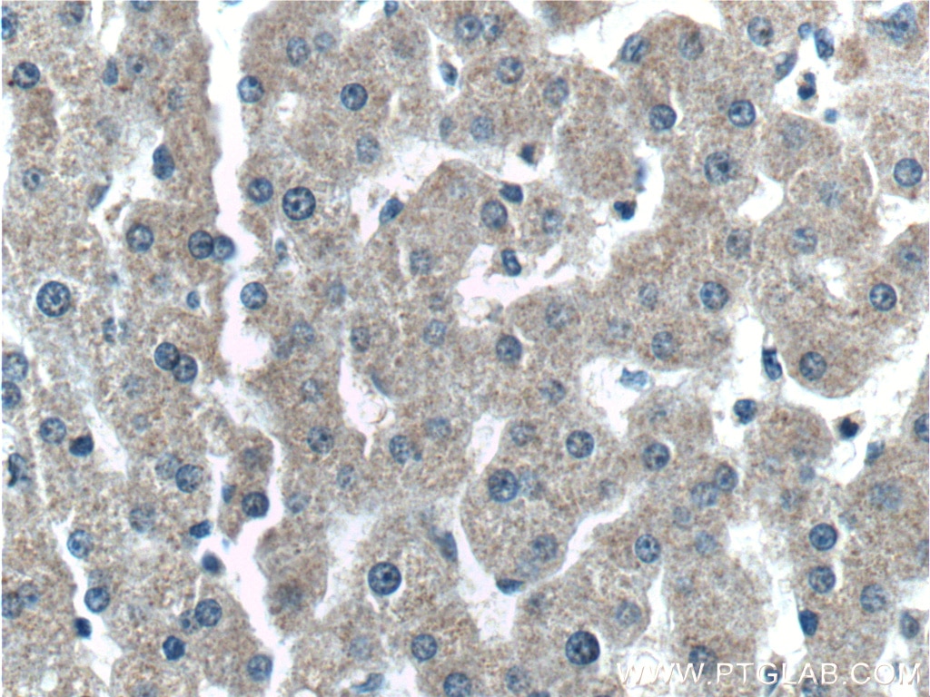 Immunohistochemistry (IHC) staining of human liver tissue using C4 Gamma Chain Monoclonal antibody (66242-1-Ig)