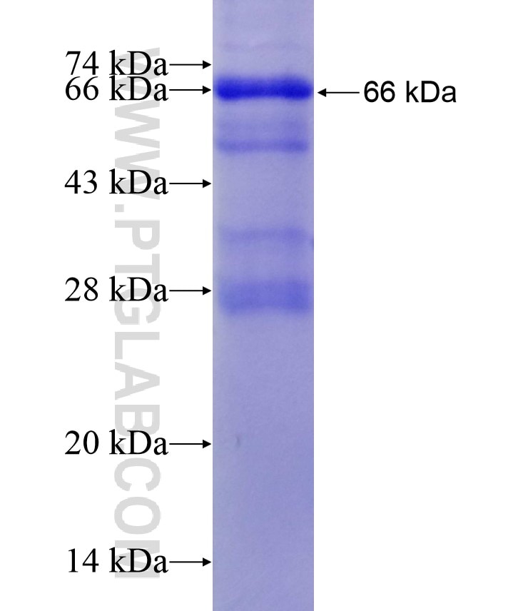 C4A fusion protein Ag17583 SDS-PAGE
