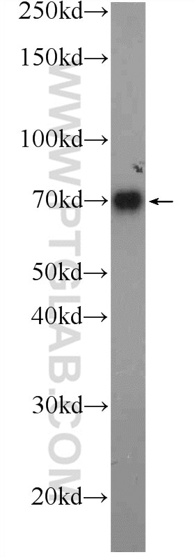 Western Blot (WB) analysis of human blood using C4BPA Polyclonal antibody (11819-1-AP)