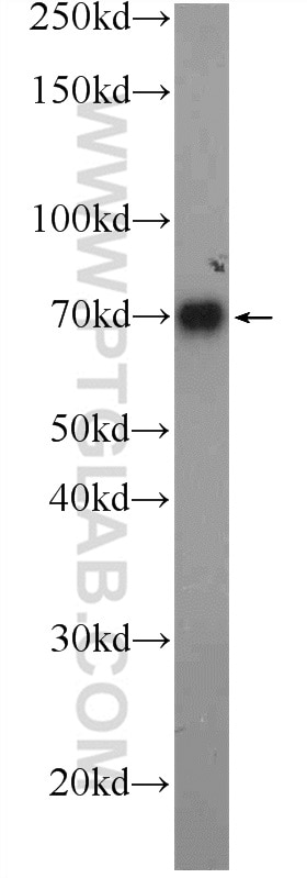 WB analysis of human blood using 11819-1-AP