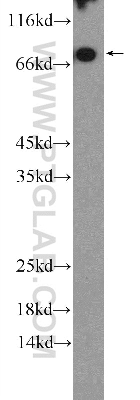 Western Blot (WB) analysis of human plasma using C4BPA Polyclonal antibody (11819-1-AP)