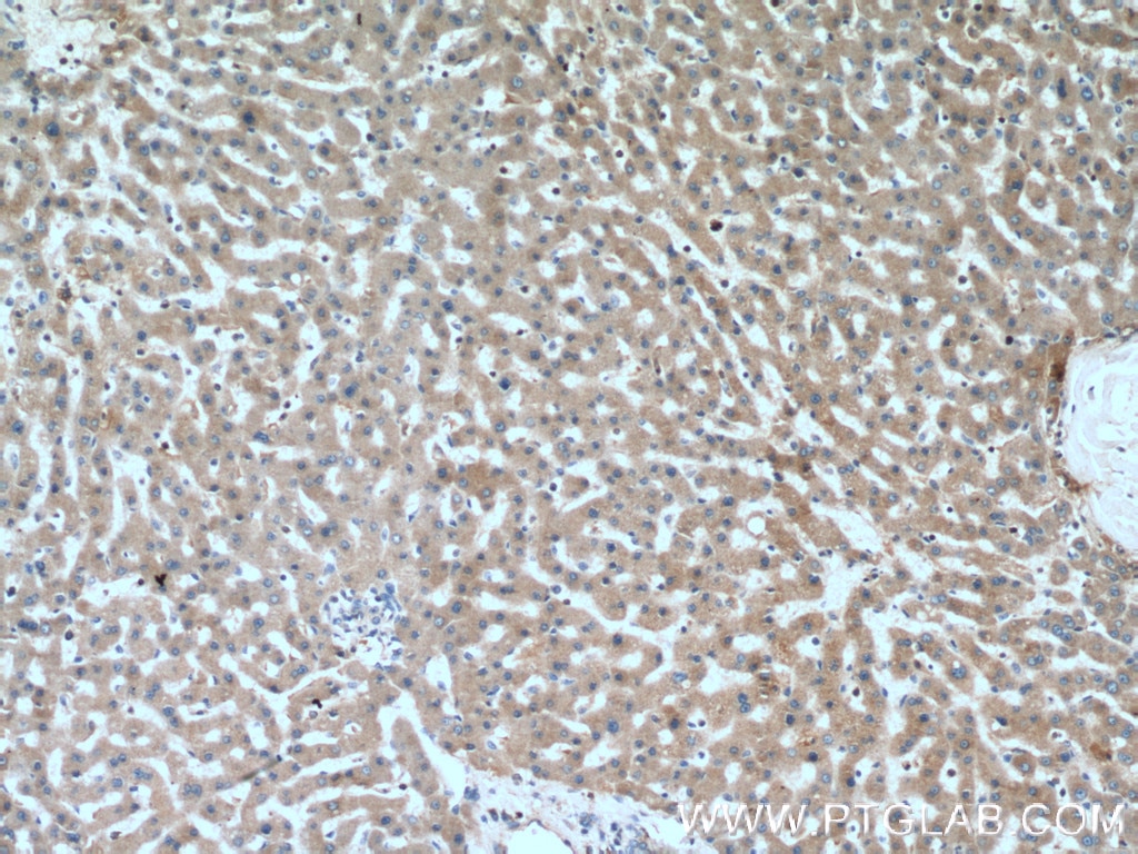 Immunohistochemistry (IHC) staining of human liver tissue using C4BPB Polyclonal antibody (15837-1-AP)