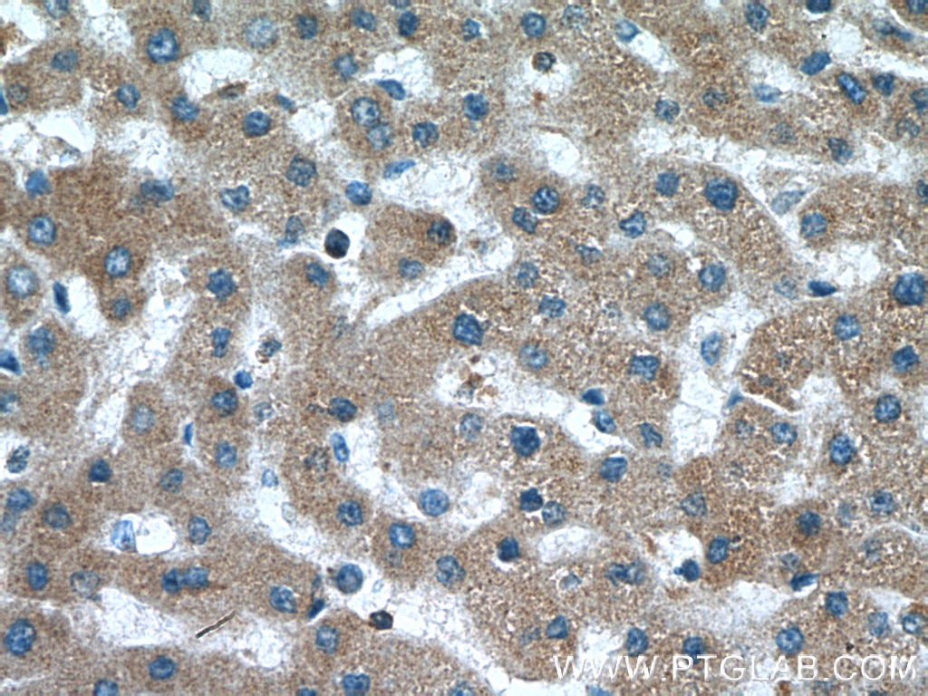Immunohistochemistry (IHC) staining of human liver tissue using C4BPB Polyclonal antibody (15837-1-AP)