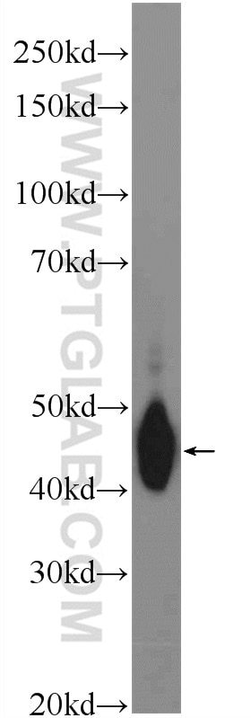 Western Blot (WB) analysis of human plasma using C4BPB Polyclonal antibody (15837-1-AP)