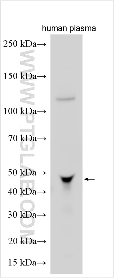 WB analysis using 15837-1-AP Western Blot (WB) analysis of various lysates using C4BPB Polyclonal antibody (15837-1-AP)