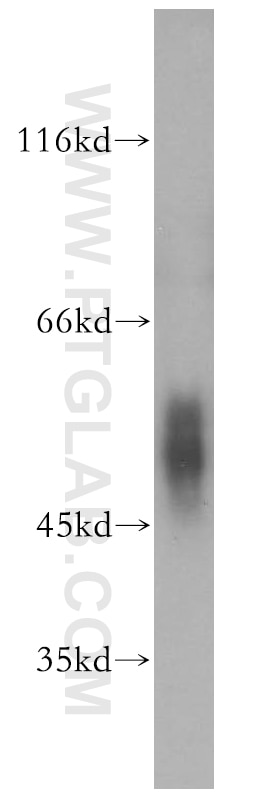 Western Blot (WB) analysis of HeLa cells using C4BPB Polyclonal antibody (15837-1-AP)