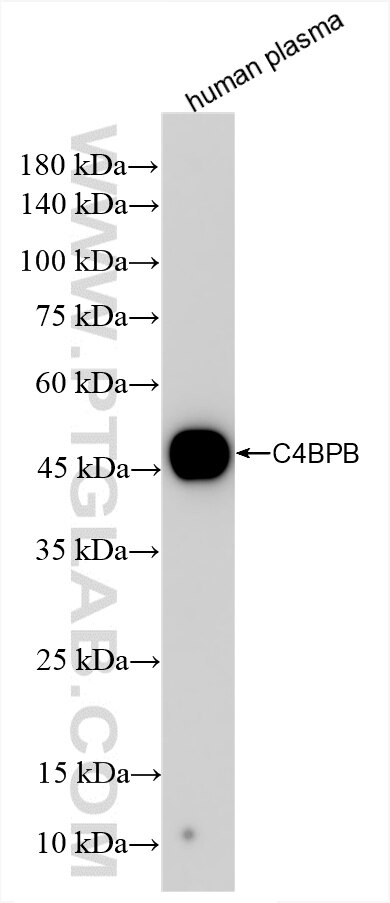 C4BPB