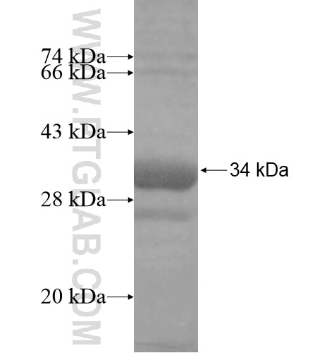 C4BPB fusion protein Ag14636 SDS-PAGE