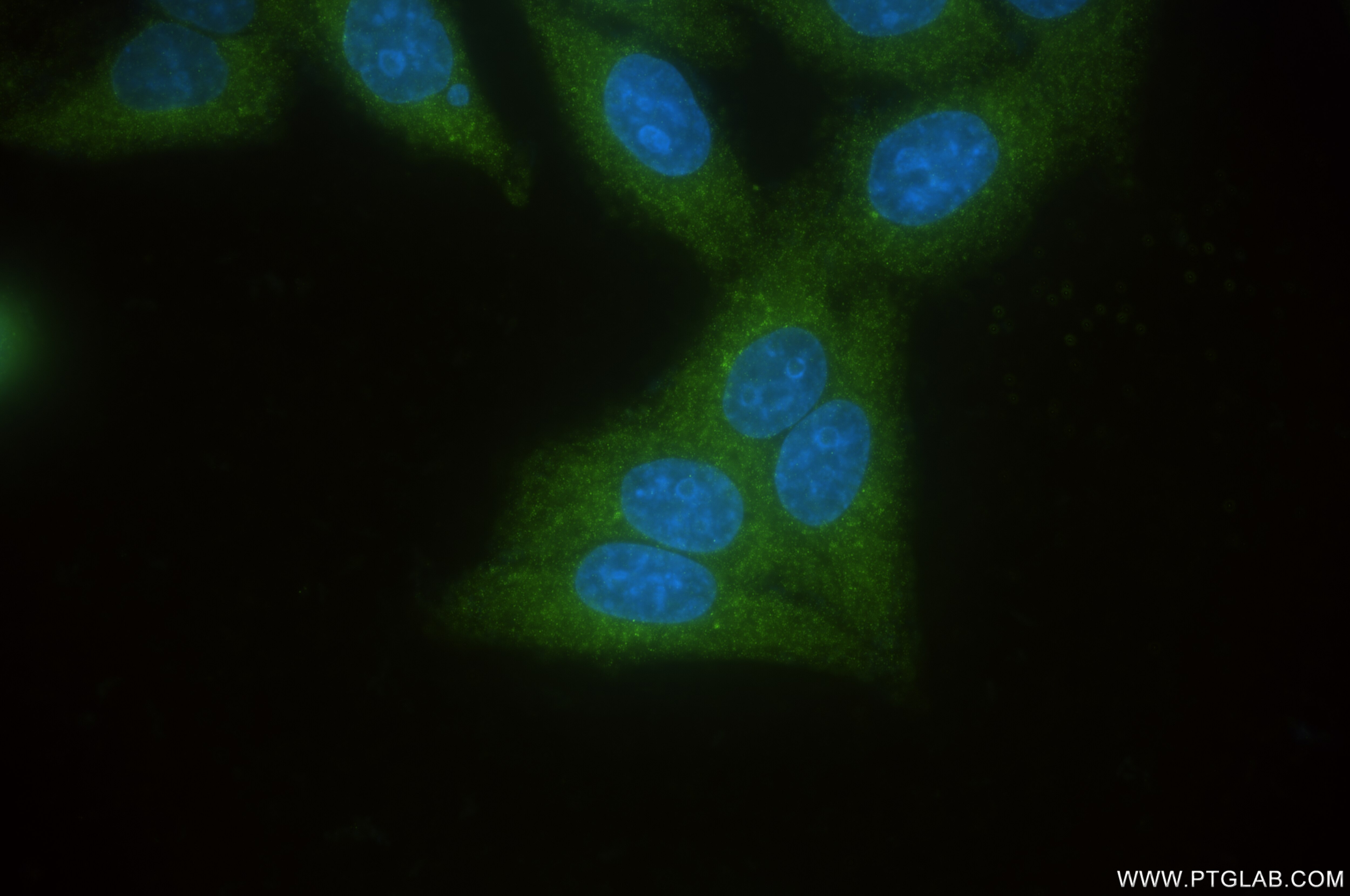 IF Staining of HepG2 using 85782-2-RR (same clone as 85782-2-PBS) Immunofluorescence (IF) / fluorescent staining of HepG2 cells using C4b Alpha Chain/C4b-B/C4d-B Recombinant monoclonal (85782-2-RR)