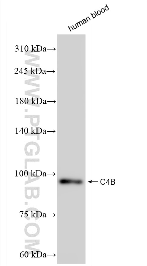 WB analysis of human blood using 85782-2-RR (same clone as 85782-2-PBS) Western Blot (WB) analysis of human blood using C4b Alpha Chain/C4b-B/C4d-B Recombinant monoclonal (85782-2-RR)