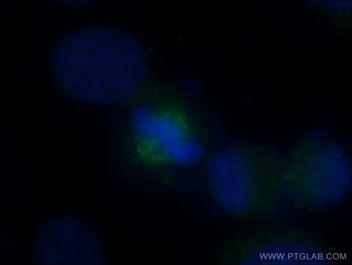 Immunofluorescence (IF) / fluorescent staining of HepG2 cells using HAUS3 Polyclonal antibody (18991-1-AP)