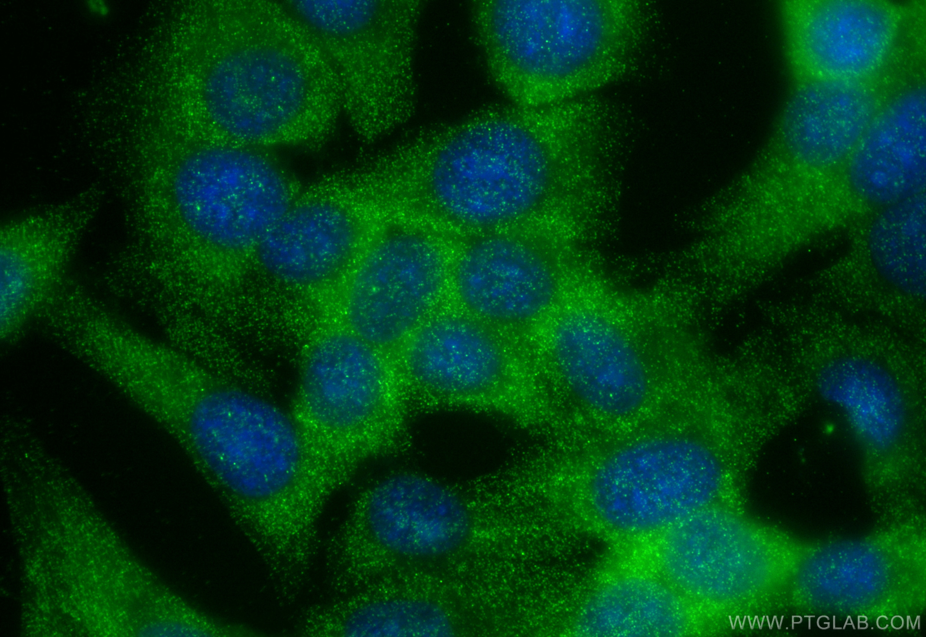 Immunofluorescence (IF) / fluorescent staining of HepG2 cells using HAUS3 Polyclonal antibody (18991-1-AP)