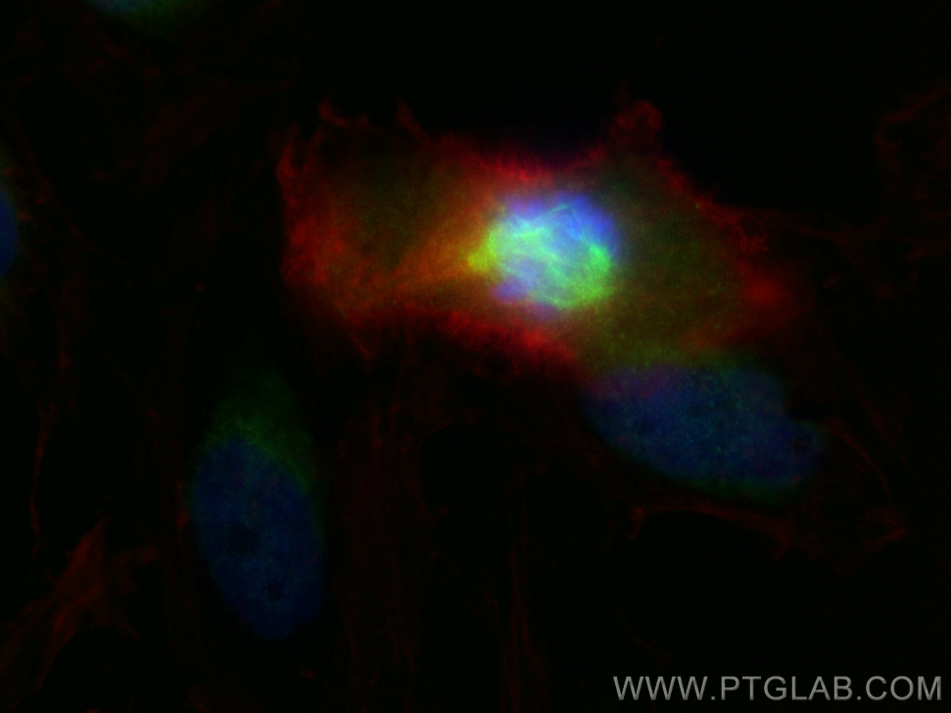 Immunofluorescence (IF) / fluorescent staining of HeLa cells using HAUS3 Polyclonal antibody (18991-1-AP)