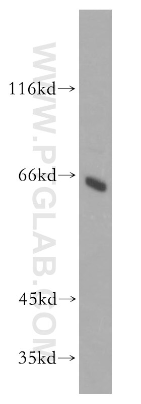 Western Blot (WB) analysis of HepG2 cells using HAUS3 Polyclonal antibody (18991-1-AP)