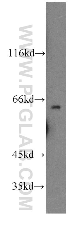 Western Blot (WB) analysis of HeLa cells using HAUS3 Polyclonal antibody (18991-1-AP)