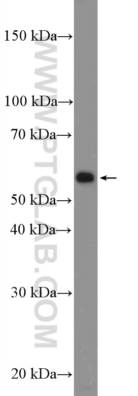 Western Blot (WB) analysis of Neuro-2a cells using C4orf18 Polyclonal antibody (25994-1-AP)