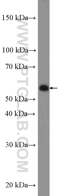 Western Blot (WB) analysis of Neuro-2a cells using C4orf18 Polyclonal antibody (25994-1-AP)