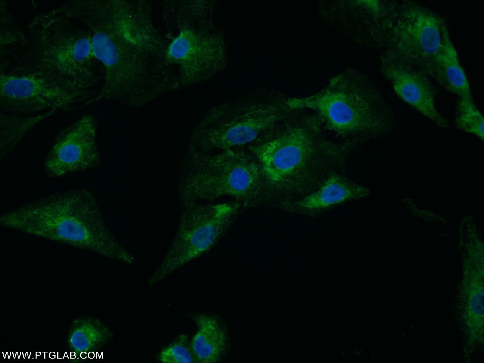 Immunofluorescence (IF) / fluorescent staining of A549 cells using C4orf29 Polyclonal antibody (25036-1-AP)