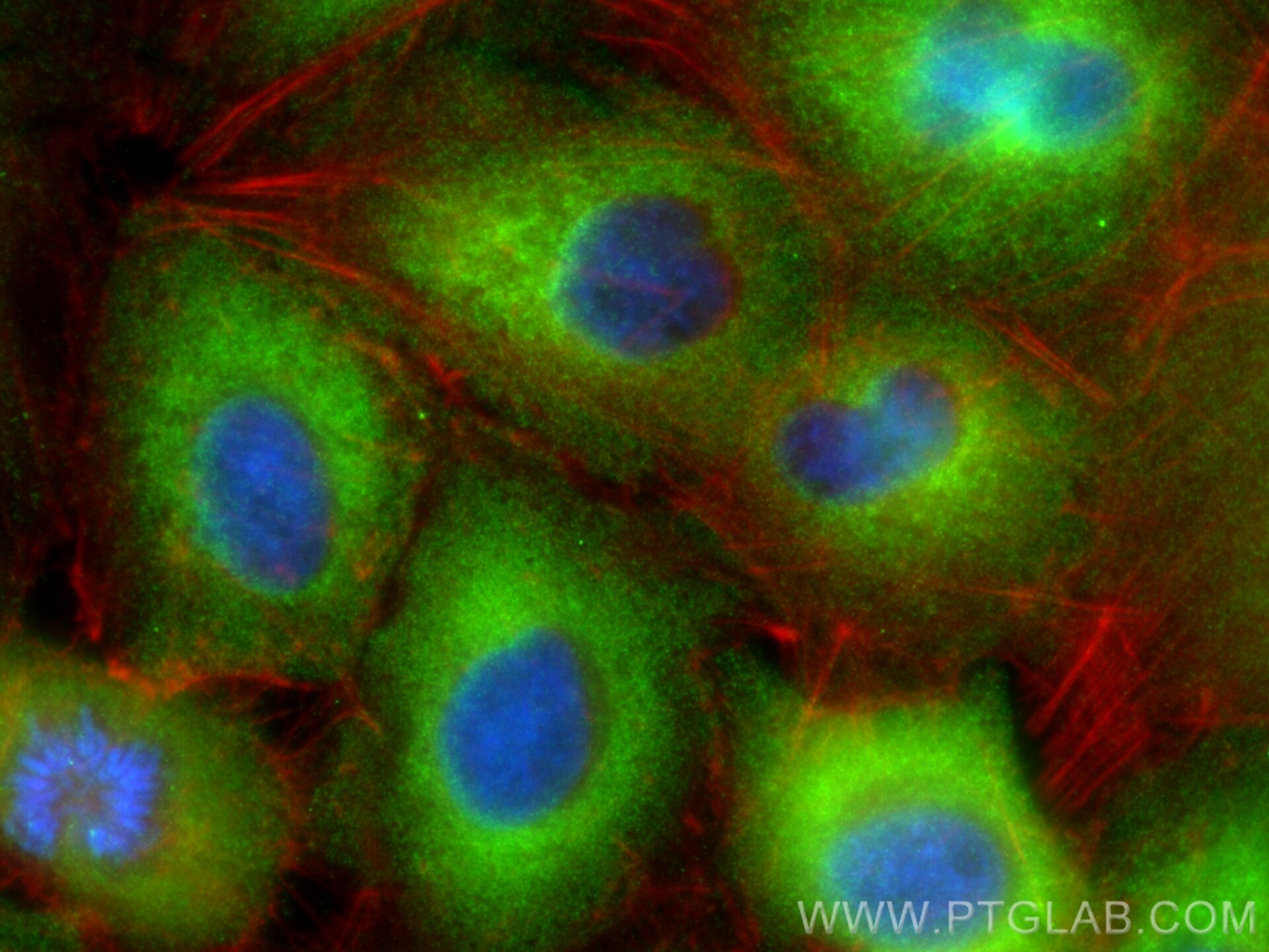 Immunofluorescence (IF) / fluorescent staining of A549 cells using ABHD18 Polyclonal antibody (25036-1-AP)