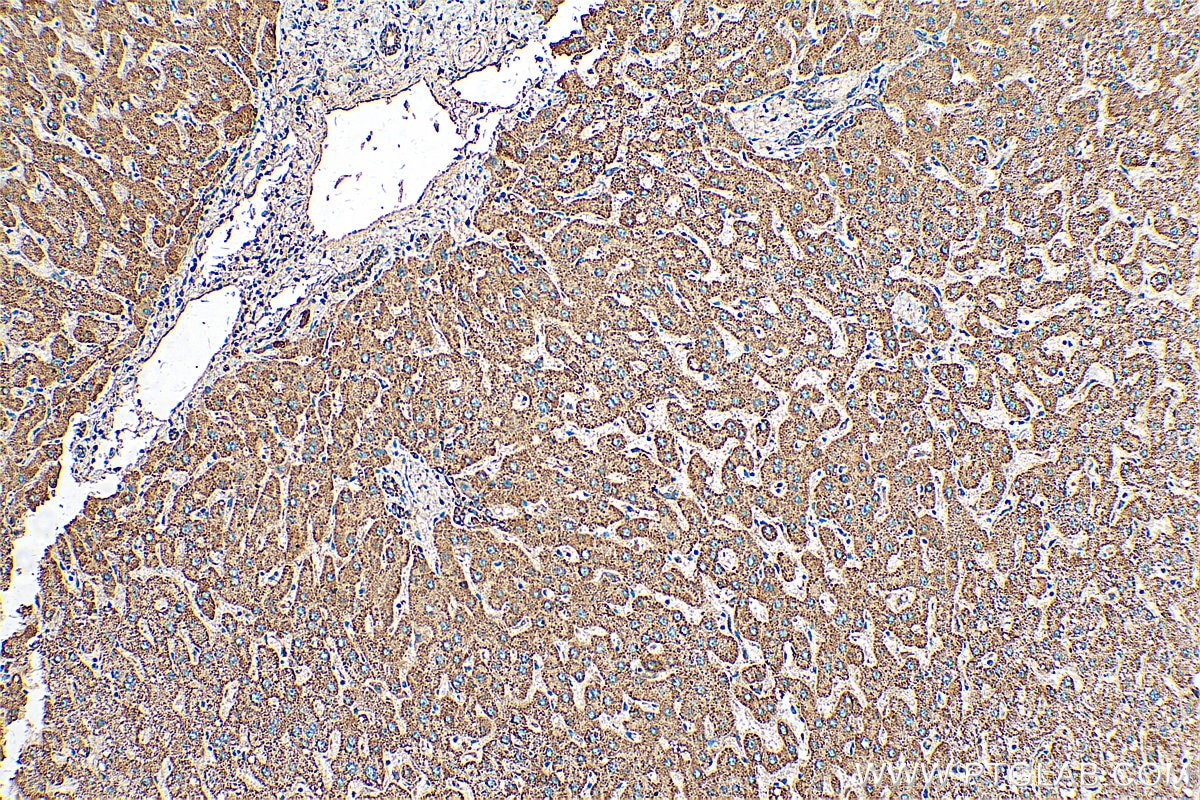 Immunohistochemistry (IHC) staining of human liver tissue using C4orf29 Polyclonal antibody (25036-1-AP)