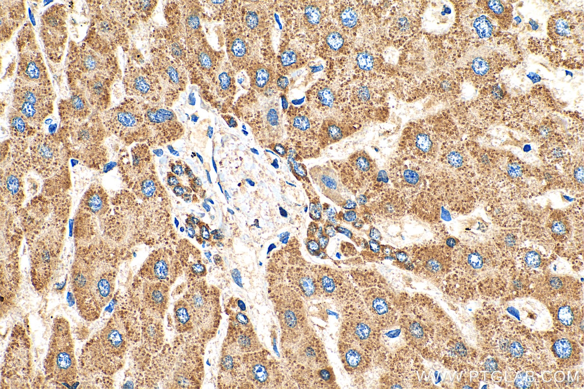 IHC staining of human liver using 25036-1-AP