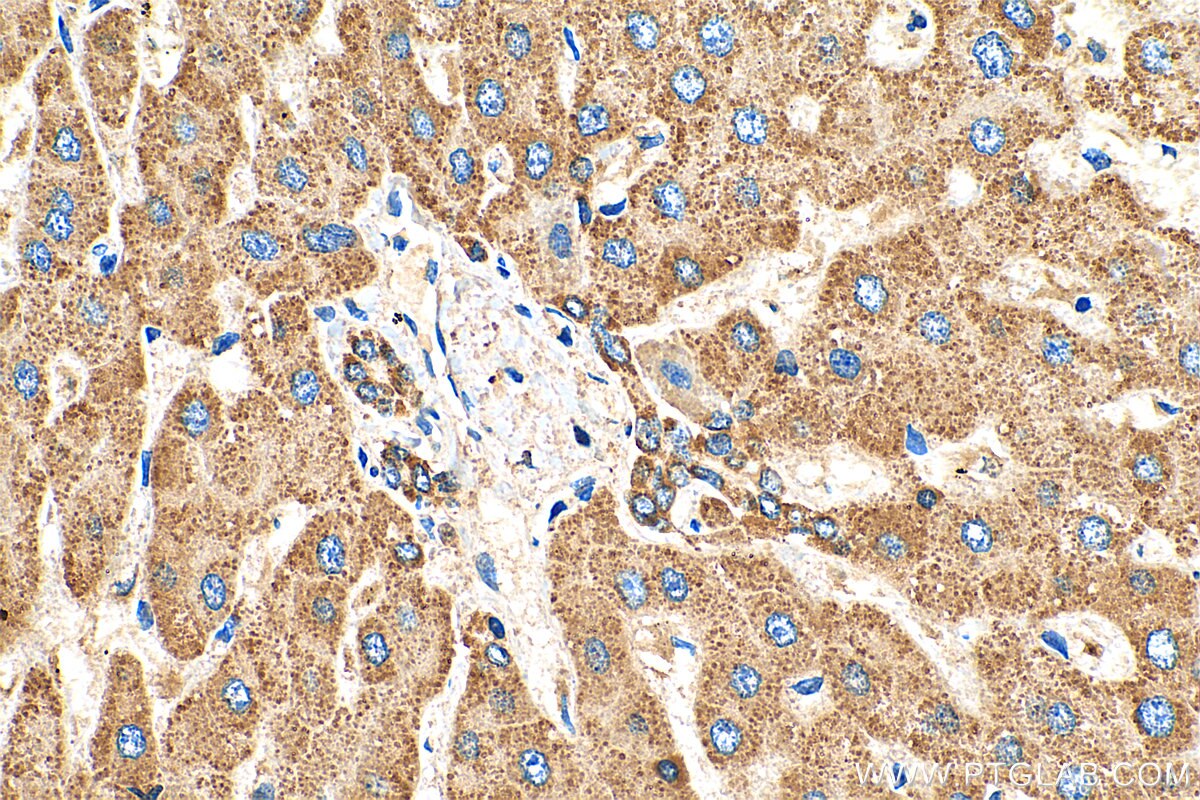 Immunohistochemistry (IHC) staining of human liver tissue using C4orf29 Polyclonal antibody (25036-1-AP)