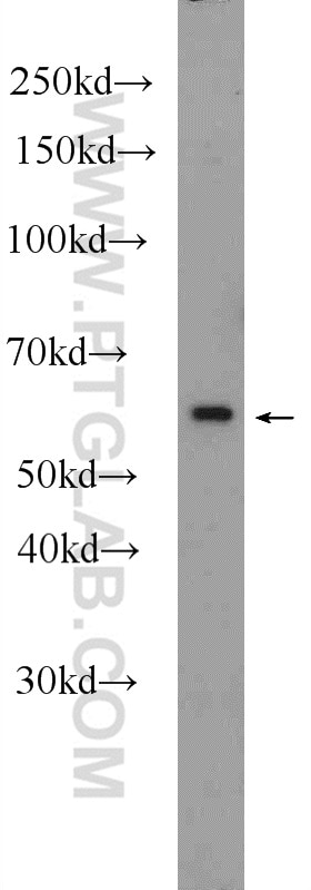 Western Blot (WB) analysis of PC-3 cells using C4orf29 Polyclonal antibody (25036-1-AP)