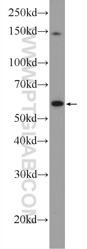 Western Blot (WB) analysis of A549 cells using C4orf29 Polyclonal antibody (25036-1-AP)
