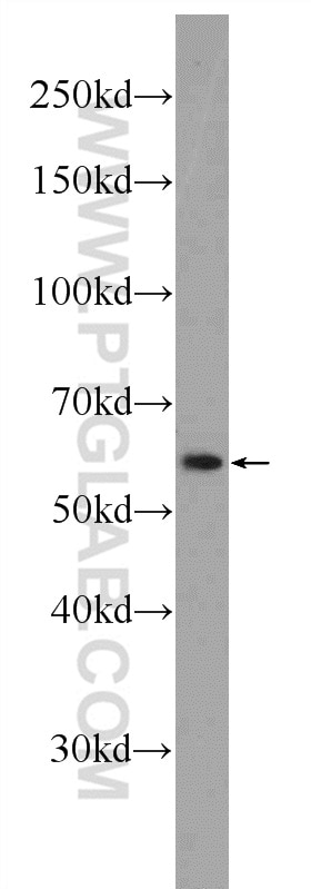 Western Blot (WB) analysis of mouse heart tissue using C4orf29 Polyclonal antibody (25036-1-AP)