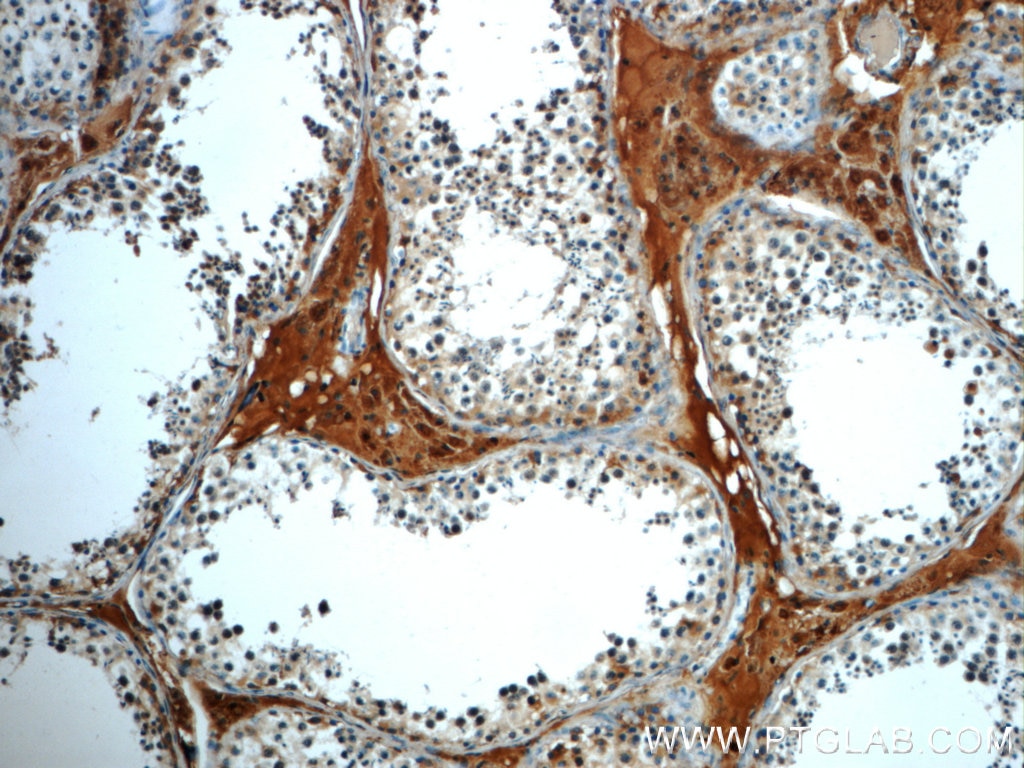 Immunohistochemistry (IHC) staining of human testis tissue using C4orf49 Polyclonal antibody (22569-1-AP)