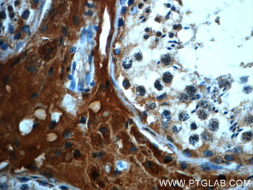 Immunohistochemistry (IHC) staining of human testis tissue using C4orf49 Polyclonal antibody (22569-1-AP)