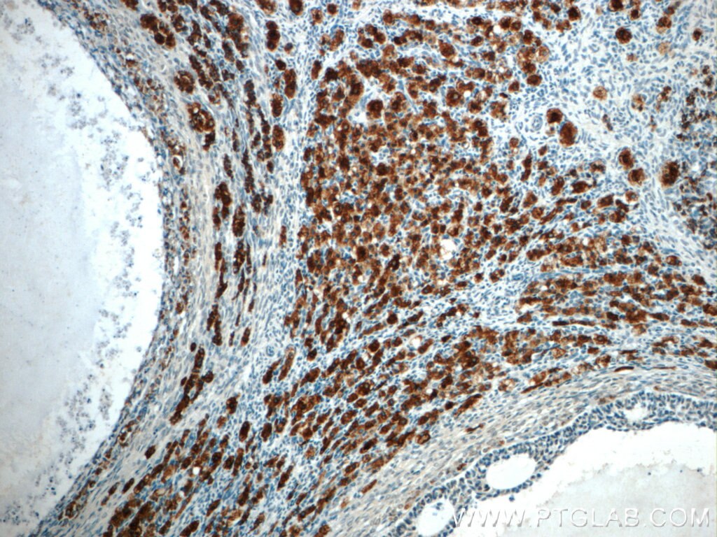 Immunohistochemistry (IHC) staining of human ovary tissue using C4orf49 Polyclonal antibody (22569-1-AP)
