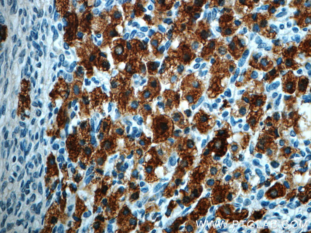 Immunohistochemistry (IHC) staining of human ovary tissue using C4orf49 Polyclonal antibody (22569-1-AP)