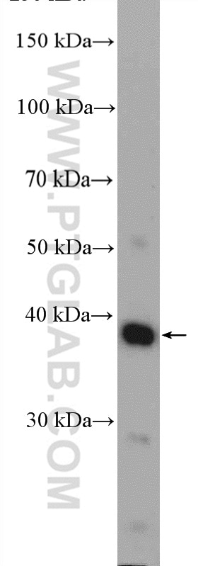 Western Blot (WB) analysis of A549 cells using C4orf49 Polyclonal antibody (22569-1-AP)