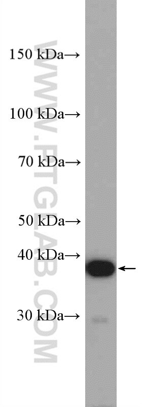 Western Blot (WB) analysis of A2780 cells using C4orf49 Polyclonal antibody (22569-1-AP)