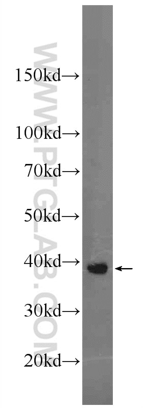 Western Blot (WB) analysis of SKOV-3 cells using C4orf49 Polyclonal antibody (22569-1-AP)