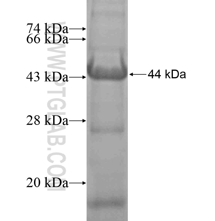 C4orf49 fusion protein Ag16552 SDS-PAGE