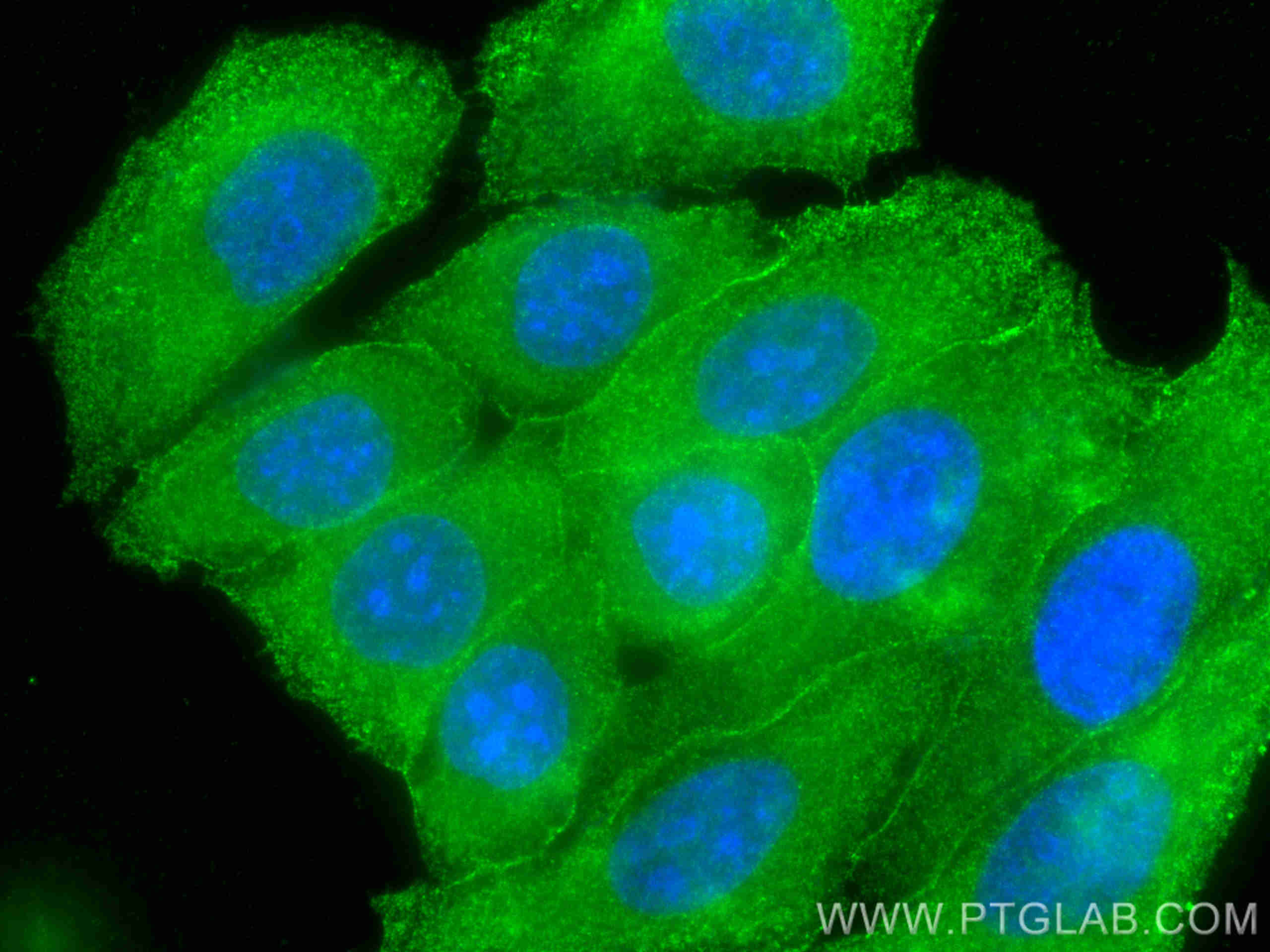 Immunofluorescence (IF) / fluorescent staining of HepG2 cells using C5 Monoclonal antibody (66634-1-Ig)