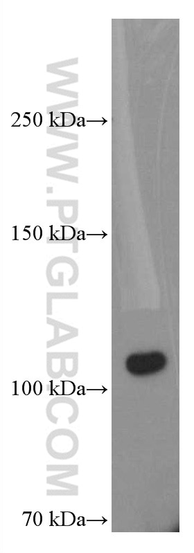Western Blot (WB) analysis of human plasma using C5 Monoclonal antibody (66634-1-Ig)