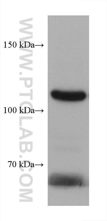 Western Blot (WB) analysis of rabbit serum using C5 Monoclonal antibody (66634-1-Ig)