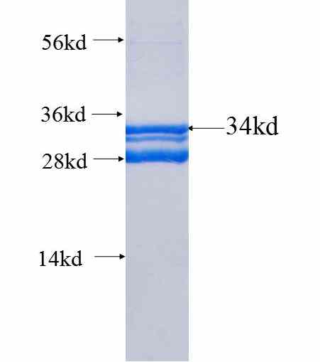 C5, C5a fusion protein Ag25581 SDS-PAGE