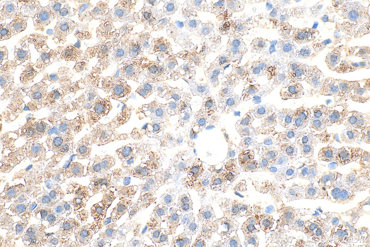 Immunohistochemistry (IHC) staining of mouse liver tissue using C5a Polyclonal antibody (32767-1-AP)