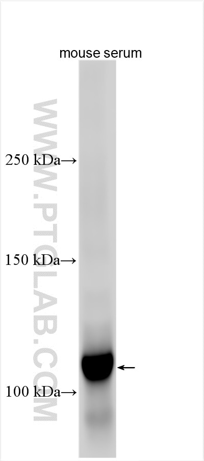 Western Blot (WB) analysis of various lysates using C5a Polyclonal antibody (32767-1-AP)