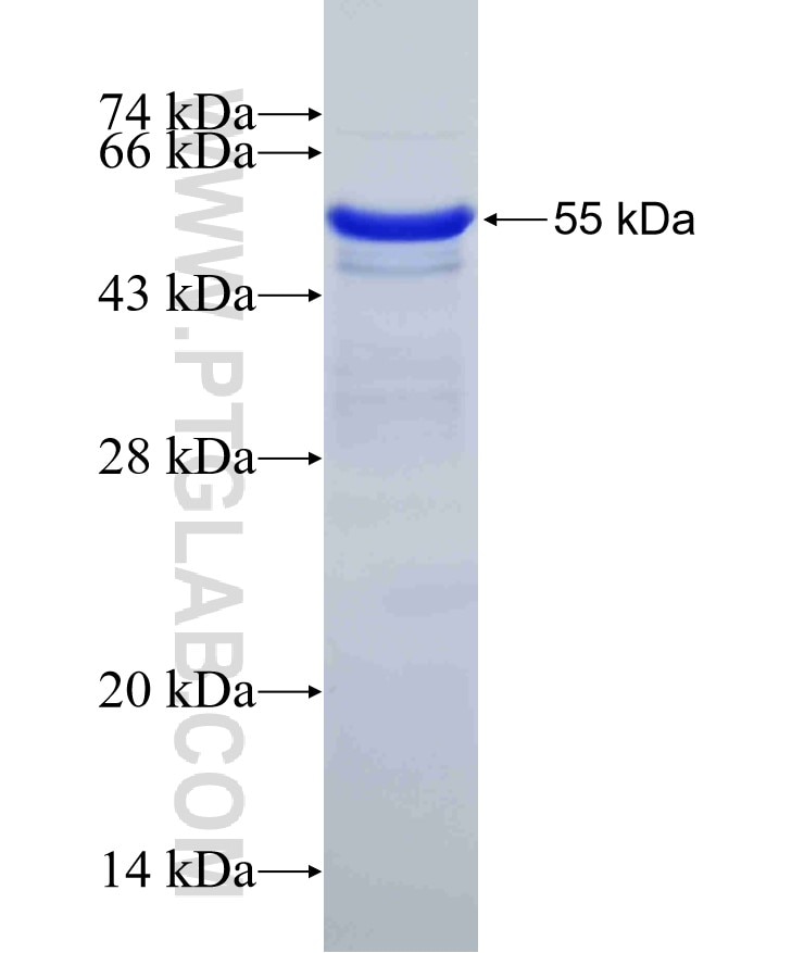 C5, C5a fusion protein Ag17801 SDS-PAGE