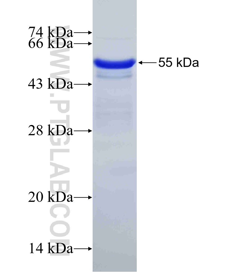 C5, C5a fusion protein Ag17801 SDS-PAGE