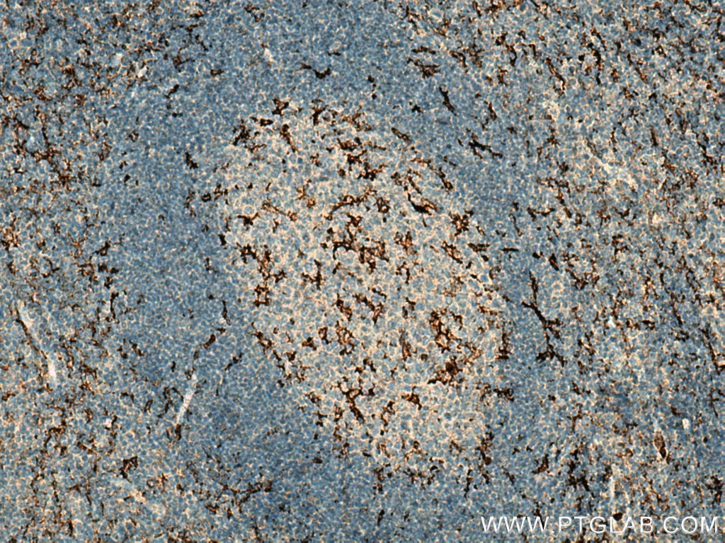 Immunohistochemistry (IHC) staining of human tonsillitis tissue using C5aR Polyclonal antibody (21316-1-AP)